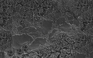 La UEx ha participado en el proyecto PHYTECH con el objetivo de desarrollar una nueva superficie para implantes óseos que contiene fitato