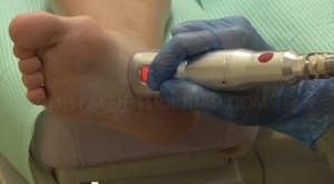 La Clínica Podológica de la UEx incorpora terapia láser entre sus servicios