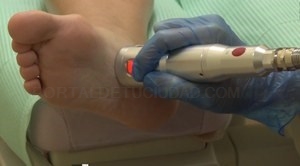 La Clínica Podológica de la UEx incorpora terapia láser entre sus servicios.