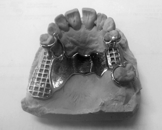 Laboratorio de Prótesis Dental Promodents