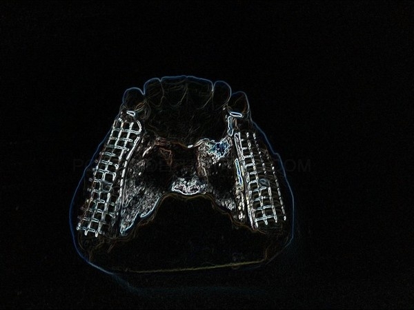 Laboratorio de Prótesis Dental Promodents