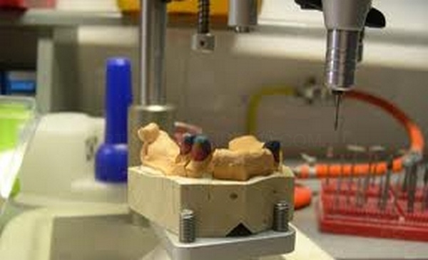 Laboratorio de Prótesis Dental Promodents