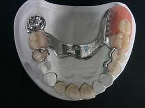 Laboratorio de Prótesis Dental Promodents
