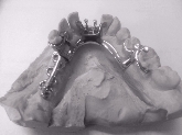 laboratorio protesis dental