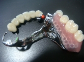 laboratorio dental
