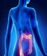 Identificado un nuevo gen de cáncer de colon hereditario