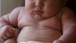 Los genes y el estilo de vida podrían explicar más del 60% de los casos de obesidad