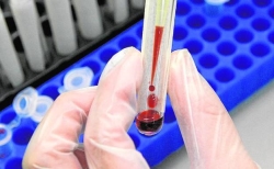 El invento valenciano para detectar alergias en menos de 30 minutos
