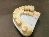 Laboratorio Dental ALDIENTE