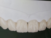 Laboratorio Dental ALDIENTE