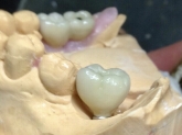 Laboratorio Dental ALDIENTE