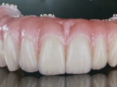 Laboratorio Dental ALDIENTE