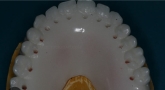 Laboratorio Dental ALDIENTE