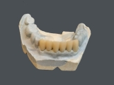 Laboratorio Dental ALDIENTE