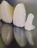 Laboratorio Dental ALDIENTE