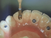 Laboratorio Dental ALDIENTE