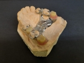 Laboratorio Dental ALDIENTE