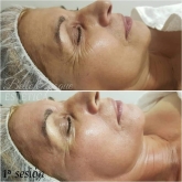 Belle Epoque Estética