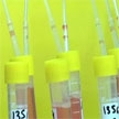 LA COMUNIDAD DE MADRID LIDERA EN ESPAÑA EL ENSAYO CLÍNICO PARA PROBAR UNA VACUNA CONTRA EL ÉBOLA