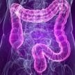 Nueva campaña de difusión y captación para la prevención de cáncer de colon