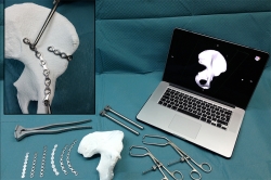 El Hospital Gregorio Marañón organiza la primera jornada sobre impresión 3D médica