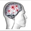 14 Centros de Mayores de la región participan en un estudio de Alzheimer