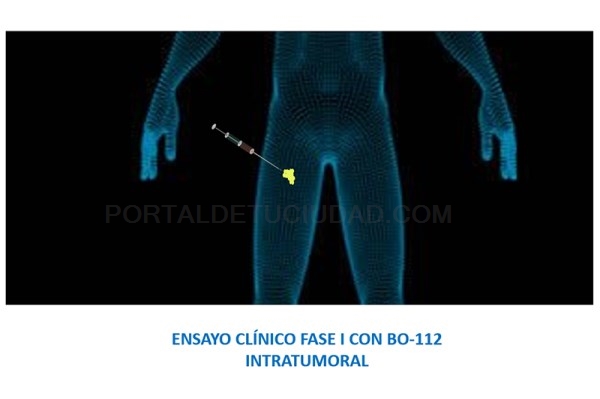El Gregorio Marañón prueba la primera inmunoterapia española contra el cáncer