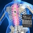 Nacimiento del proyecto Europeo ByAxon para investigar el desarrollo de un bypass para lesiones medulares