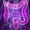 Nueva campaña de difusión y captación para la prevención de cáncer de colon