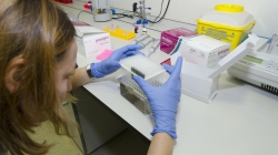 El Hospital Gregorio Marañón demuestra la utilidad de la biopsia líquida.