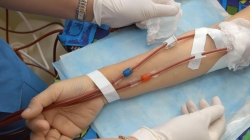 El Hospital Universitario del Sureste,ha comenzado a utilizar la hemodiálisis domiciliaria en una mujer de 40 años, trasplantada en dos ocasiones.