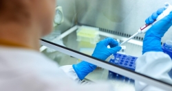 Financiamos un trabajo para reparar tejido nervioso dañado tras un ictus cerebral
