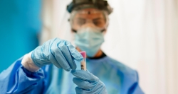 El Hospital de La Princesa invierte un millón de euros en detección y tratamiento del COVID-19