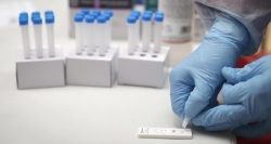 Adquirimos test de antígenos para COVID-19 por 22,5 millones de euros