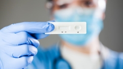 Ampliamos a otras 17 zonas básicas de salud la realización de test de antígenos
