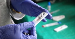 Ampliamos a 41 los dispositivos de Pruebas Rápidas de VIH con la incorporación de 5 centros