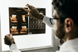 Factores a tener en cuenta a la hora de elegir una buena clínica dental