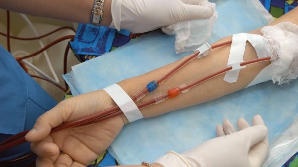 El Hospital Universitario del Sureste,ha comenzado a utilizar la hemodiálisis domiciliaria en una mujer de 40 años, trasplantada en dos ocasiones.
