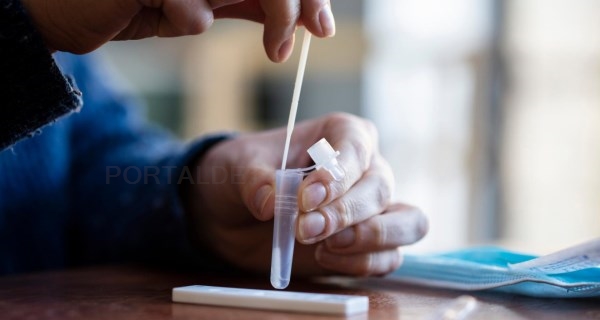 La Comunidad de Madrid establece un protocolo para actuar en caso de positivo con test de autodiagnóstico