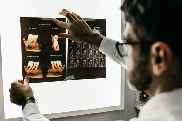 Factores a tener en cuenta a la hora de elegir una buena clínica dental