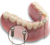 Clínica Dental Medidental Plus