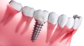 Clínica Dental Medidental Plus