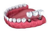 Clínica Dental Medidental Plus