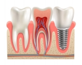 Clínica Dental Medidental Plus