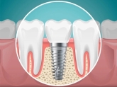 Clínica Dental Medidental Plus
