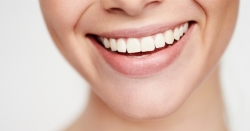 Te contamos cuáles son los mejores tratamientos en Estética Dental