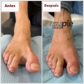 Clínica Podológica Supie