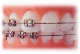 CLÍNICA ODONTOLÓGICA - Villuela Dental