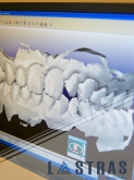 Laboratorio Dental Lastras en Valladolid