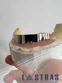 Laboratorio Dental Lastras en Valladolid